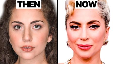 lady gaga surgery|Lady Gaga’s new look sparks plastic surgery debate